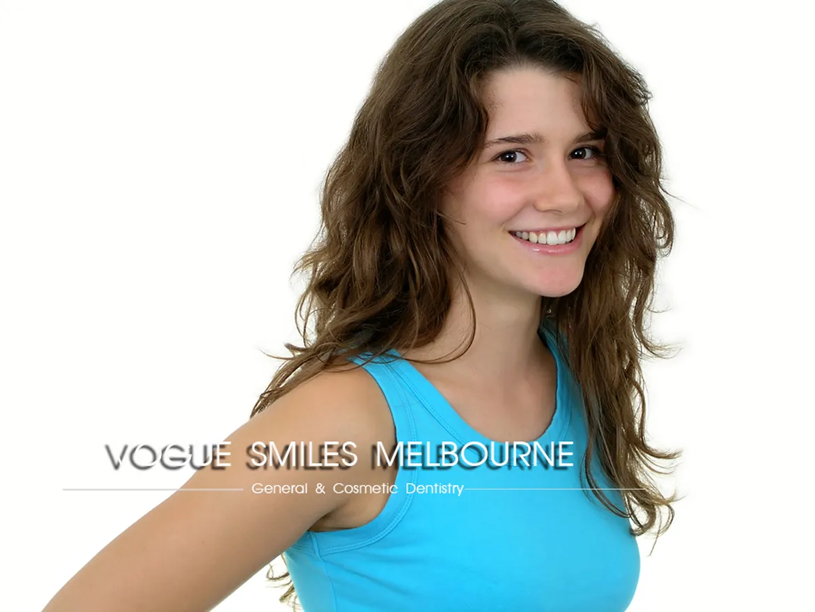 Porcelain Inlays and Onlays for Tooth Decay Repair Melbourne