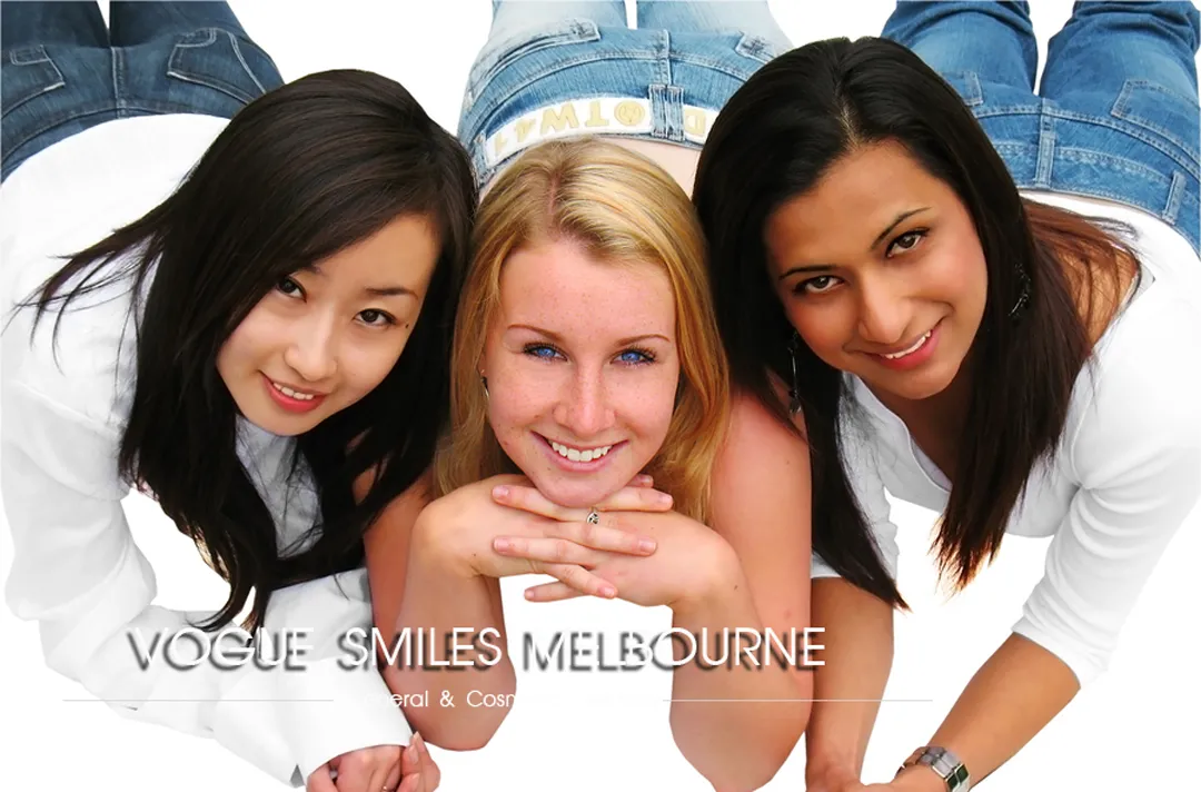  Melbourne Veneers Price Guide: Explore Budget Options