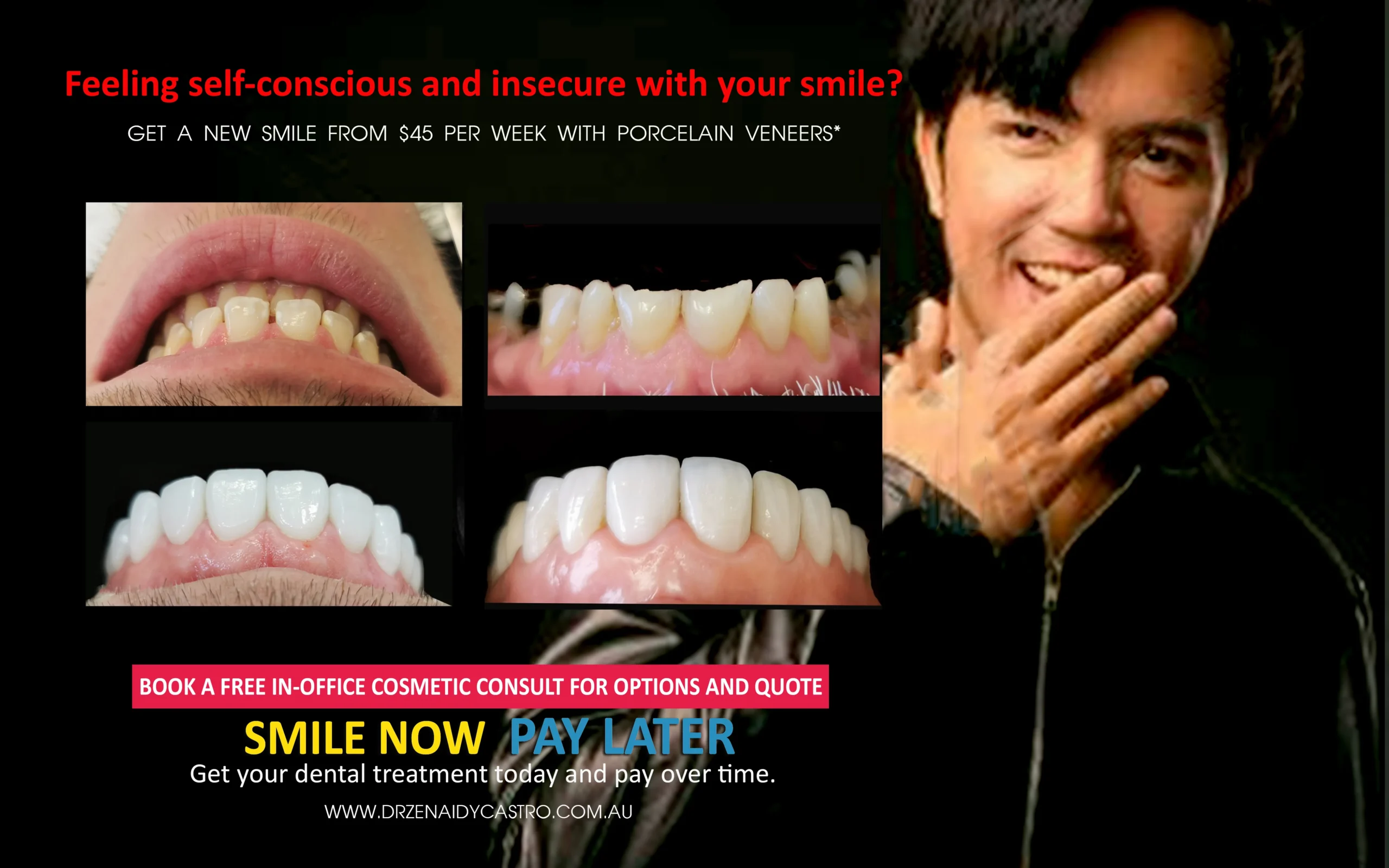 How to Finance Your Smile Makeover Without Breaking the Bank